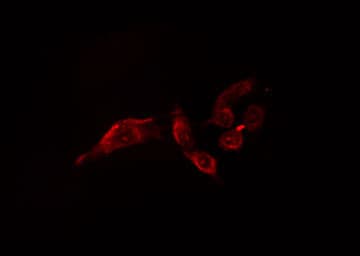 Polyclonal Rabbit anti-Human OTUB1 / OTU1 Antibody (IHC, IF, WB)