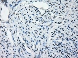 AURKC / Aurora C Antibody (clone OTI10A7)