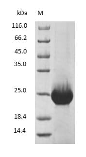 RBP4 Protein (Native)