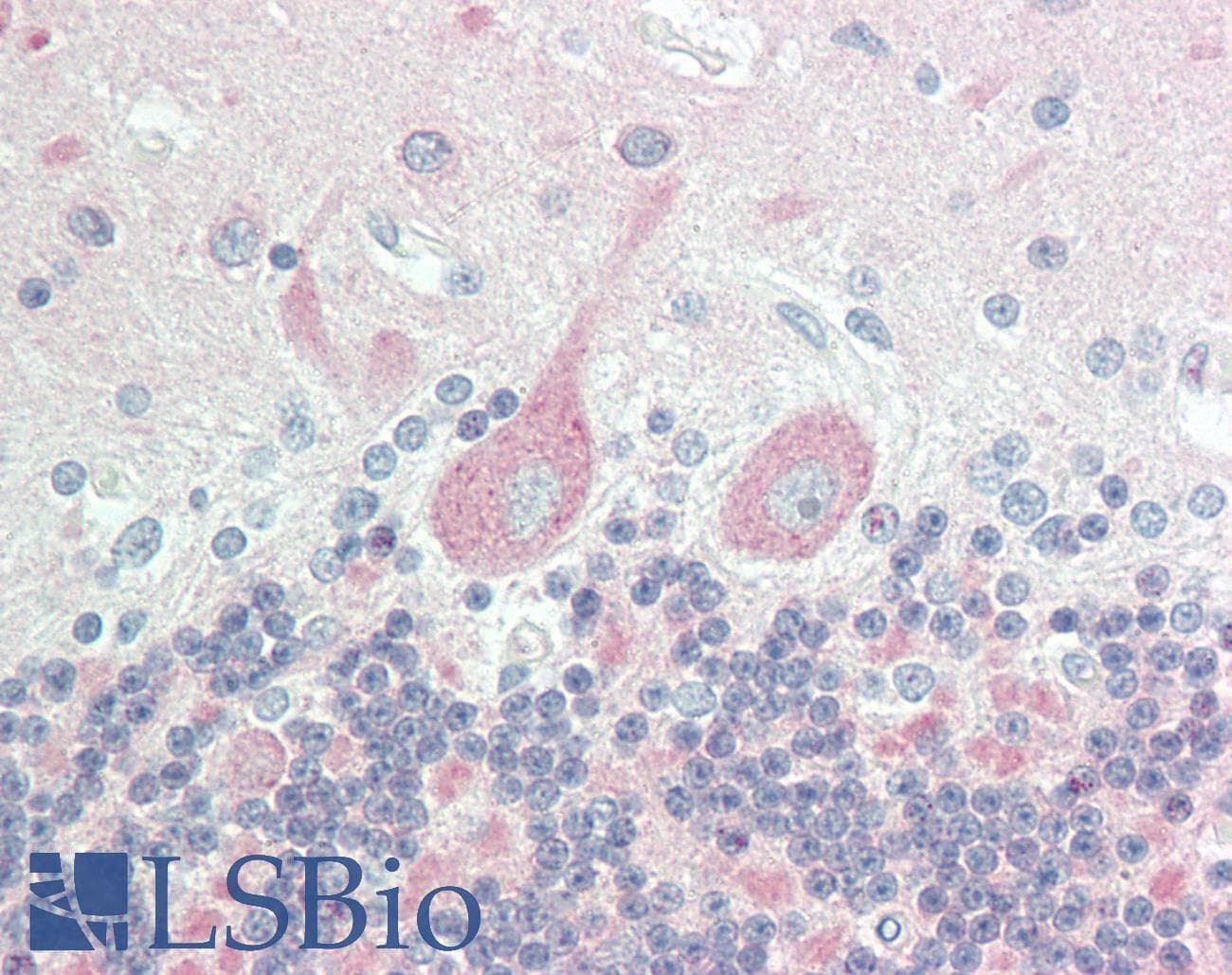 HPCAL1 / Hippocalcin-Like 1 Antibody (C-Terminus)