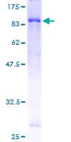 Human ULK4 Protein (Recombinant GST)