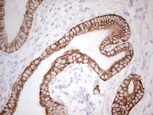 Monoclonal Mouse anti-Human ABCB1 / MDR1 / P Glycoprotein Antibody (clone OTI11D2, aa995-1280, IHC)