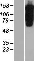 PUM1 Protein (Over-Expression Lysate Myc-DDK (Flag))