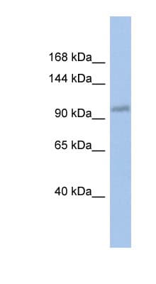 Polyclonal Rabbit anti-Human DDX24 Antibody (C-Terminus, WB)