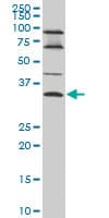 IHC-plus™ Monoclonal Mouse anti-Human EPSTI1 Antibody (clone 2A8, IHC, WB)