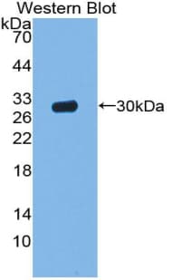ACP5 / TRAP Antibody (aa28-286, HRP)