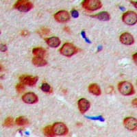 Polyclonal Rabbit anti-Human INPP5J / PIB5PA Antibody (C-Terminus, IHC, IF, WB)