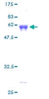 Human AMT Protein (Recombinant GST)