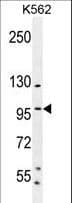 SP1 Antibody (aa677-707)