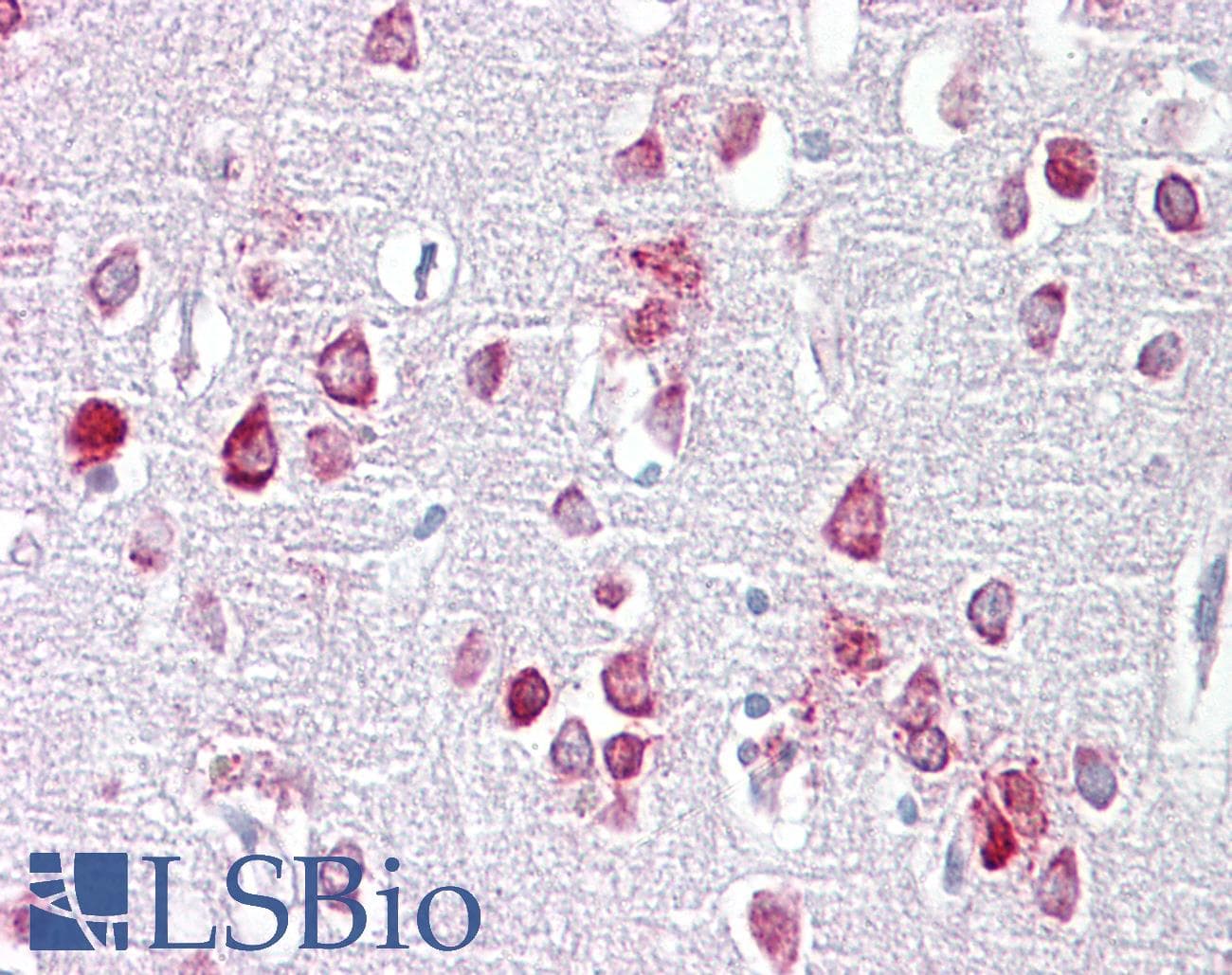 Polyclonal Rabbit anti-Human PME-1 / PPME1 Antibody (aa35-84, IHC, WB)