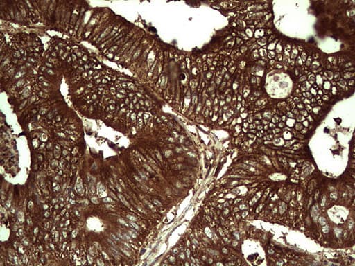 PKM2 Antibody (clone 1G10)