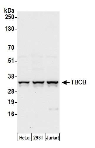 TBCB / CKAP1 Antibody (aa75-125)