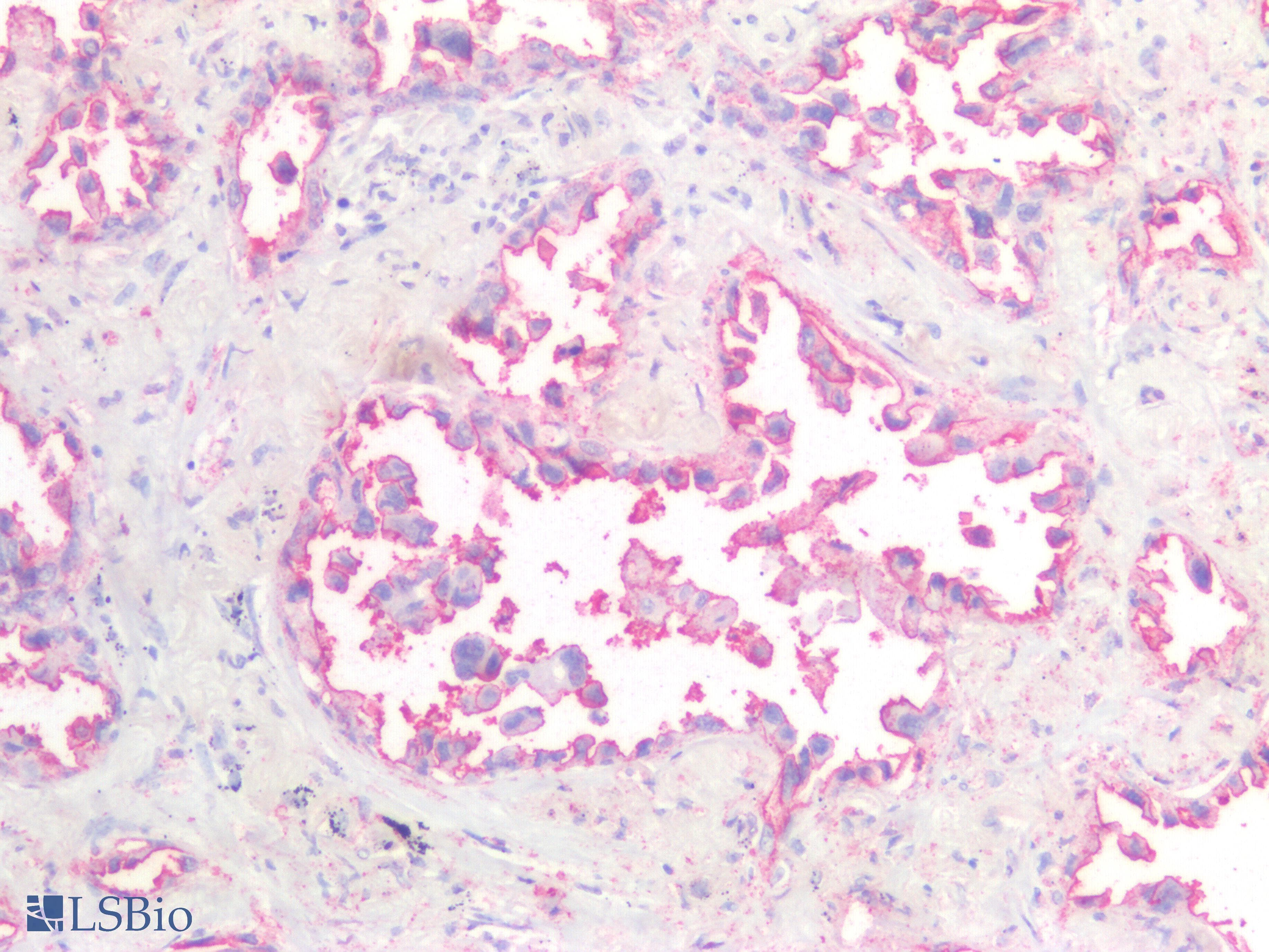 IHC-plus™ KRAS Antibody
