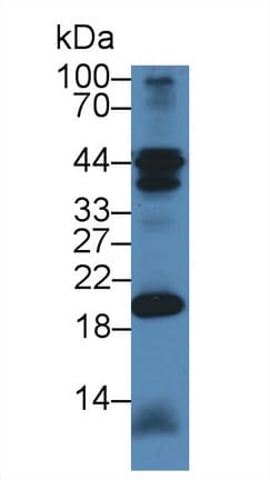 CHN2 / Chimerin 2 Antibody (aa101-323, PE)