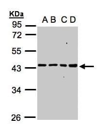 Polyclonal Rabbit anti-Human MRPS5 Antibody (aa1-430, IHC, WB)