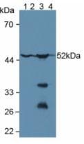 GSS / Glutathione Synthetase Antibody (aa268-474)
