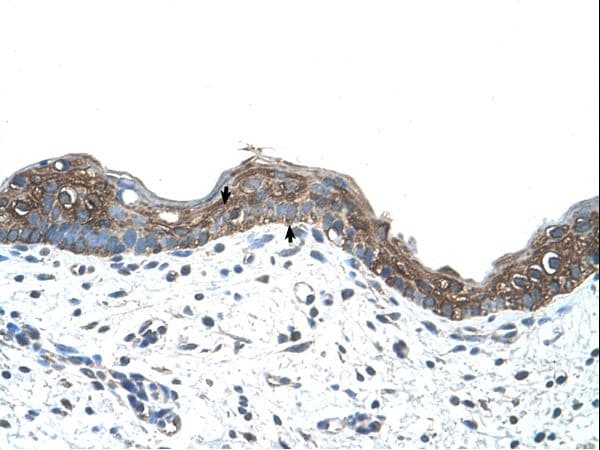 Polyclonal Rabbit anti-Human ANK1 / Ankyrin Antibody (C-Terminus, IHC, WB)