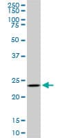 Monoclonal Mouse anti-Human UCHL3 Antibody (clone 4E9, WB)