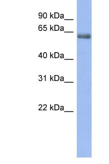 Polyclonal Rabbit anti-Human GABRE Antibody (aa35-84, WB)
