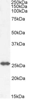 IHC-plus™ Polyclonal Goat anti-Human GSTM4-4 / GSTM4 Antibody (Internal Region, IHC, WB)