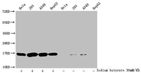 Polyclonal Rabbit anti-Human HIST1H3A Antibody (IHC, IF, WB)