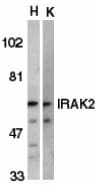 IHC-plus™ IRAK2 / IRAK-2 Antibody