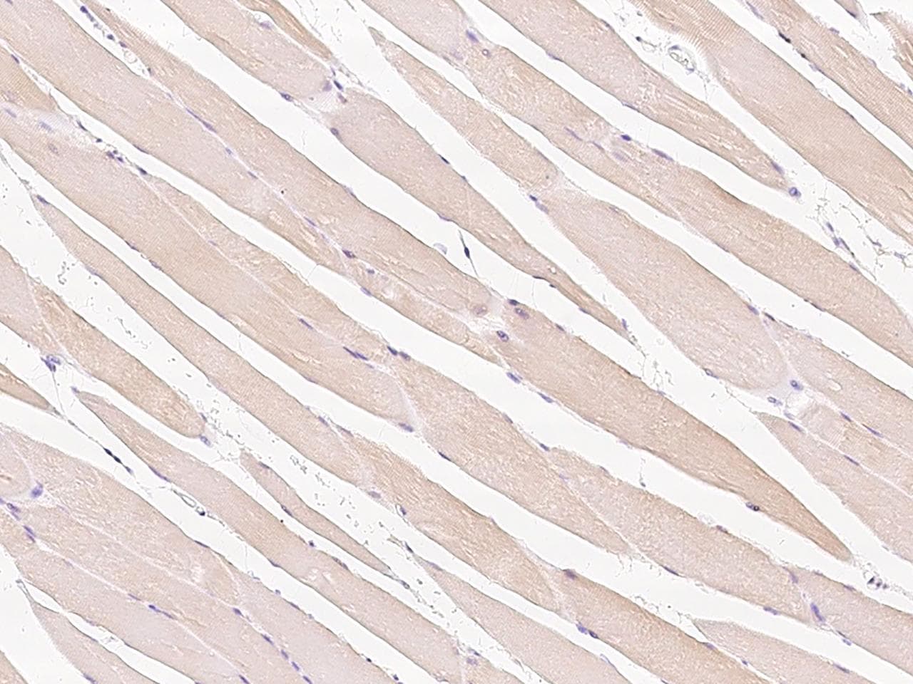 HSPB8 / H11 / HSP22 Antibody