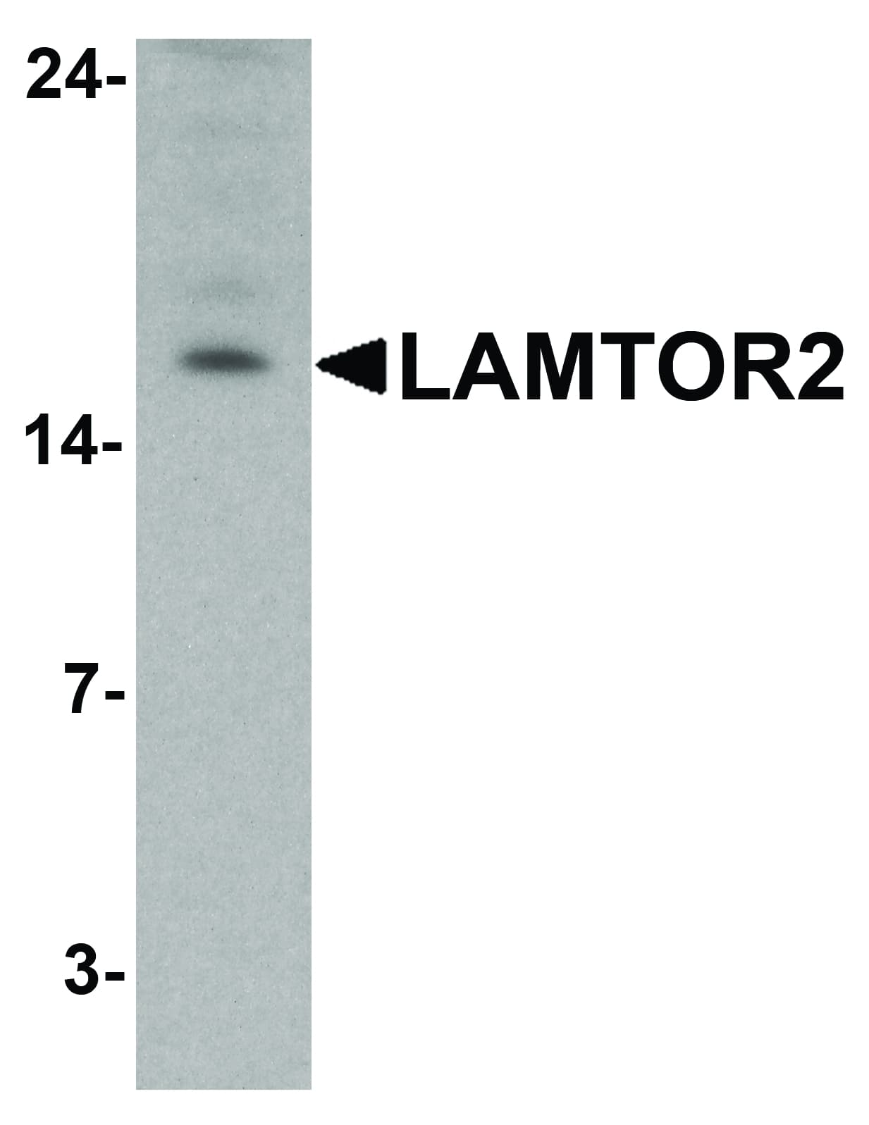 Polyclonal Rabbit anti-Human LAMTOR2 Antibody (IHC, IF, WB)
