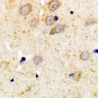 Polyclonal Rabbit anti-Human PRKCA / PKC-Alpha Antibody (IHC, WB)