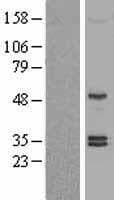Human SHH / Sonic Hedgehog Protein (Over-Expression Lysate Myc-DDK (Flag))