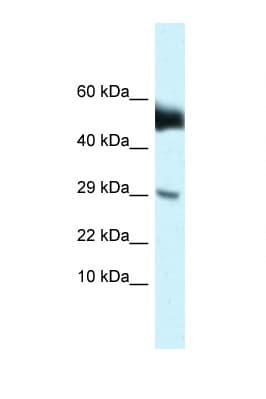 AMHR2 / MISRII Antibody (N-Terminus)