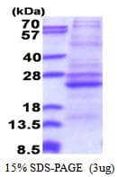 Human ATP5F1 Protein (Recombinant His)