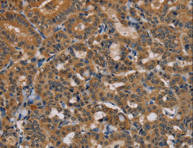 NAP1 / TAB3 Antibody