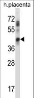 UBE2J1 Antibody (aa1-30)