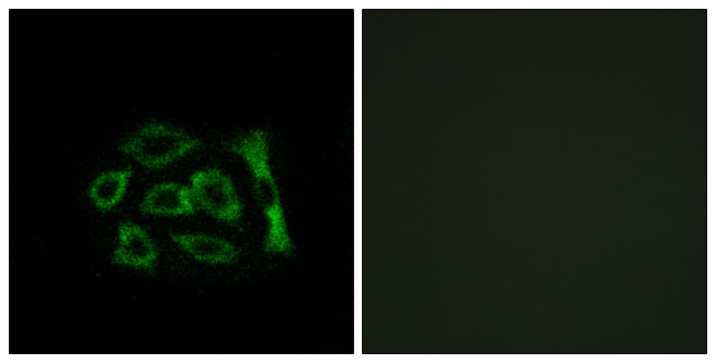 IHC-plus™ Polyclonal Rabbit anti-Human KDELR2 Antibody (aa81-130, IHC, IF, WB)