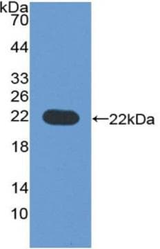 CYP3A4 / Cytochrome P450 3A4 Antibody (aa344-497, Biotin)
