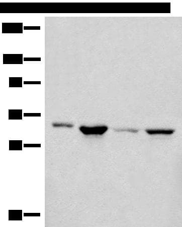 CDC7 Antibody