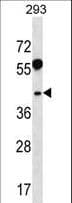 Polyclonal Rabbit anti-Human RRAGB / RAGB Antibody (aa1-30, WB)