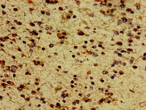 MC5R / MC5 Receptor Antibody
