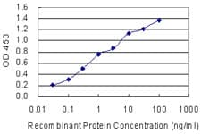 SSX1 Antibody (clone 5B2)