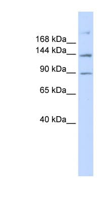 ABCB4 / MDR3 Antibody (aa252-301)