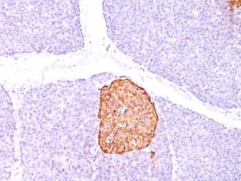 CHGA / Chromogranin A Antibody (clone CHGA/798)