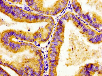 ADCY8 / Adenylate Cyclase 8 Antibody