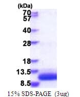 Human GNGT1 Protein (Recombinant His)