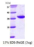 Human TPMT Protein (Recombinant)