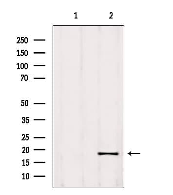 RPP25L / C9orf23 Antibody