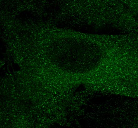 Polyclonal Goat anti-Discosoma mCherry Antibody (IHC, IF, WB)