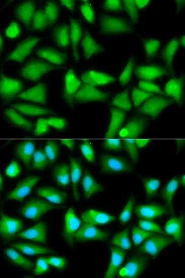 IHC-plus™ GSS / Glutathione Synthetase Antibody