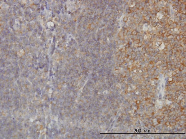 RAB21 Antibody (clone 1F6)
