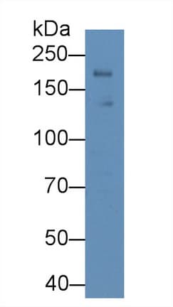 LEPR / Leptin Receptor Antibody (aa238-375, APC)